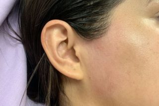Side face wax