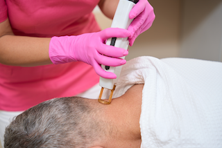 laser-hair-removal-on-back-of-head-of-man-2023-11-27-05-22-28-utc